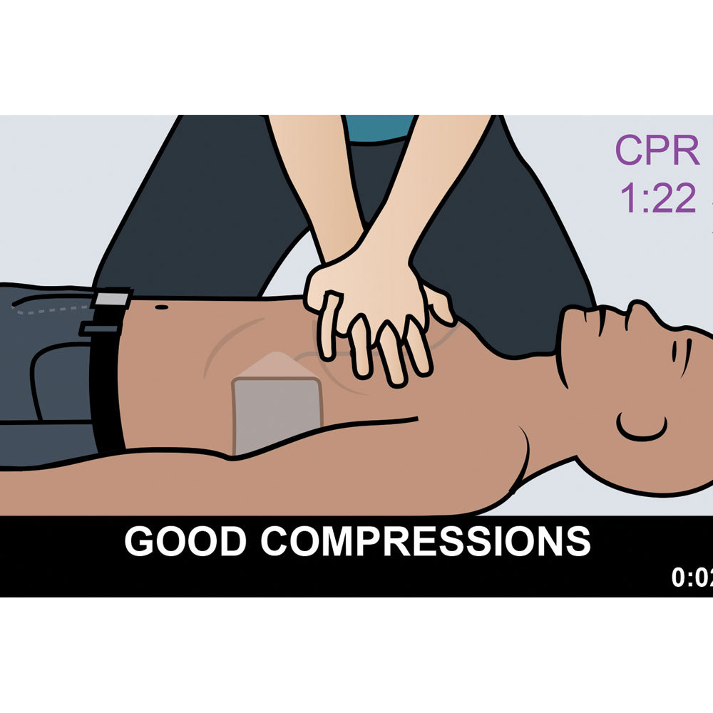 Zoll AED3 Defibrillator - Image 4
